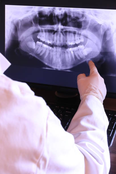 Best Knocked-Out Tooth Emergency  in Douglass, KS