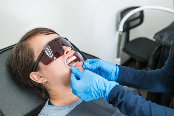 Best Teeth Whitening  in Douglass, KS